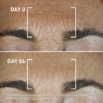 Filorga Global-Repair Advanced Intensive Elixir Youth